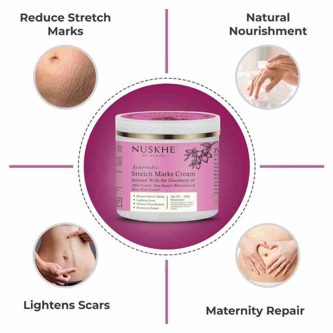 Nuskhe By Paras Ayurvedic Stretch Marks Cream - 100 gm